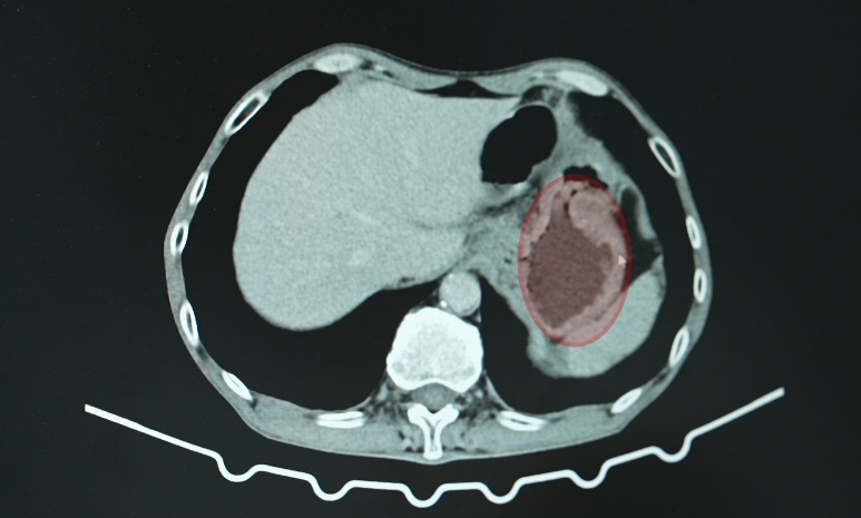 case6-3