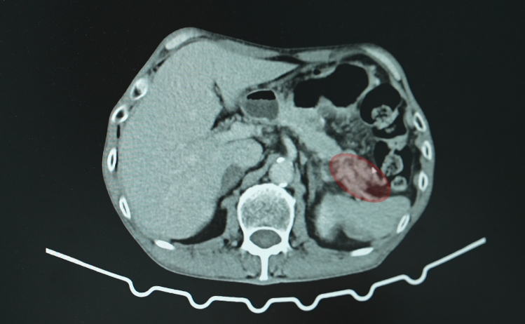 case6-4