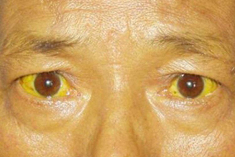 liu
