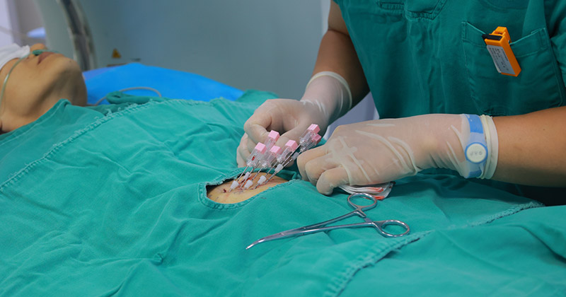 cancer treatment